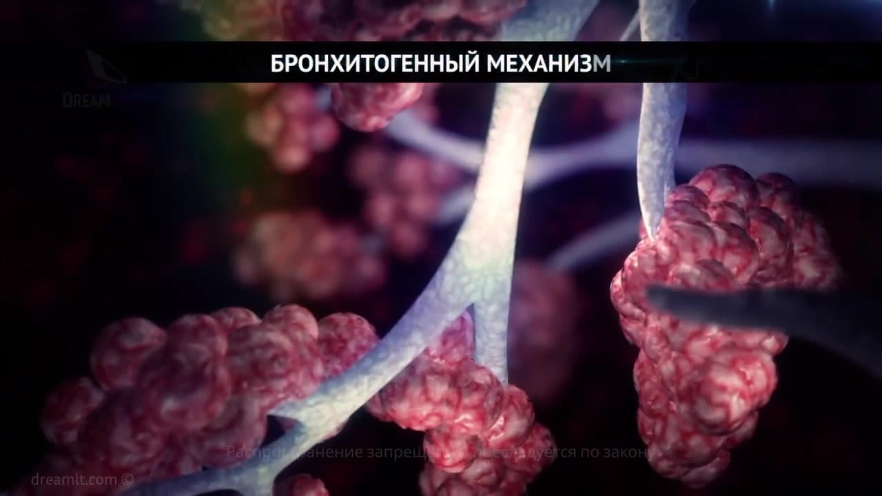 Хронические диффузные заболевания легких