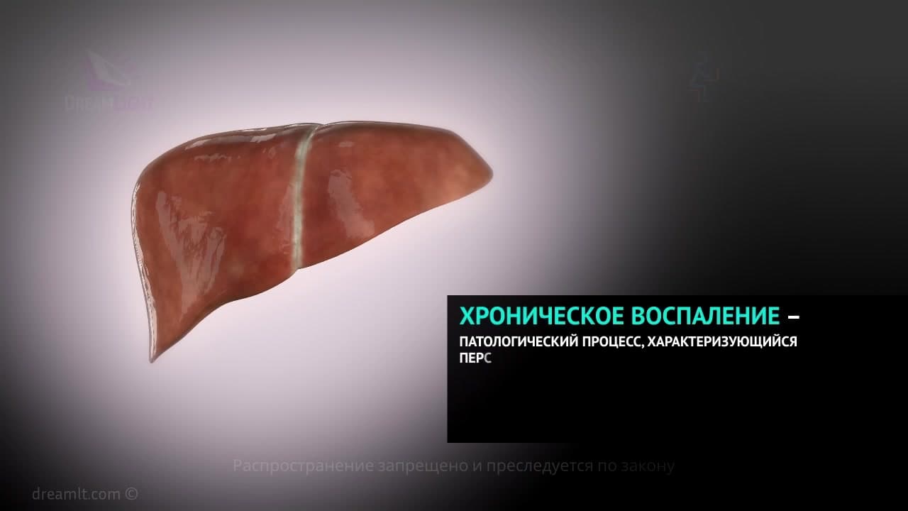 Хроническое и иммунное воспаление