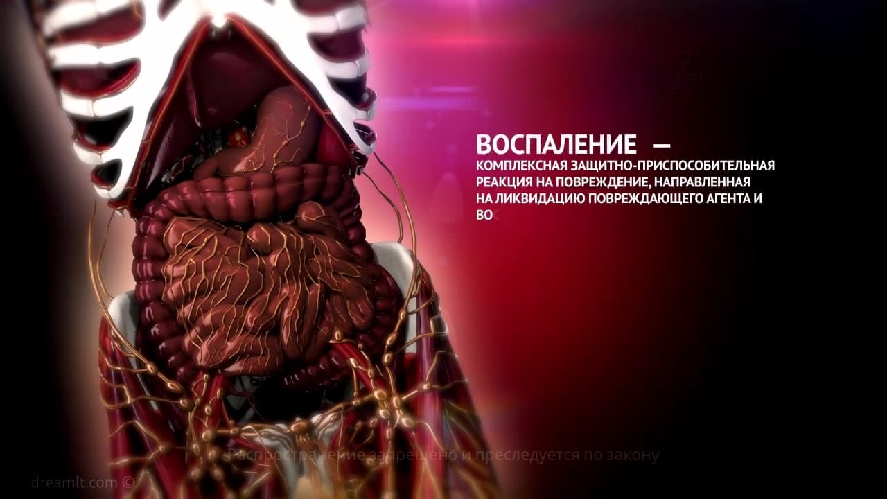 Воспаление