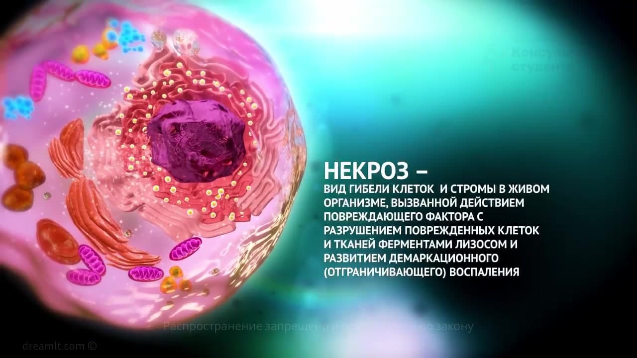 Necrosis & Apoptosis