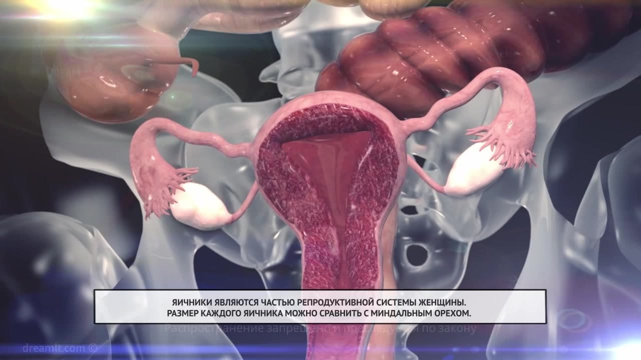 Рак яичников