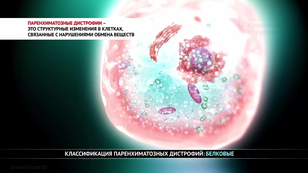 Паренхиматозные дистрофии