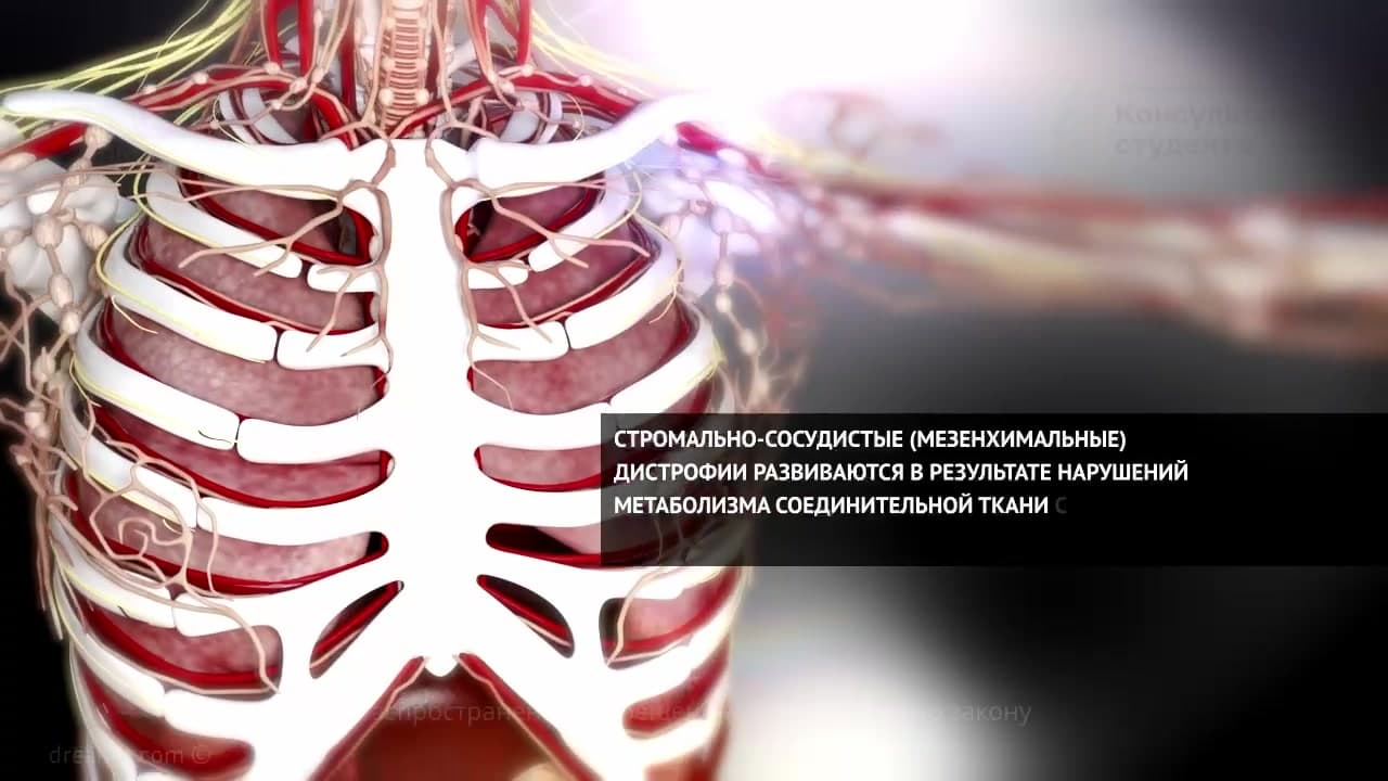 Стромально-сосудистые (мезенхимальные) дистрофии