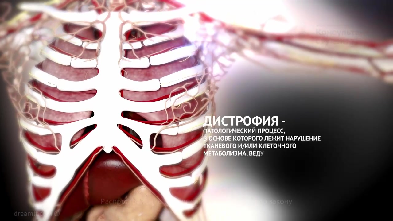 Дистрофии