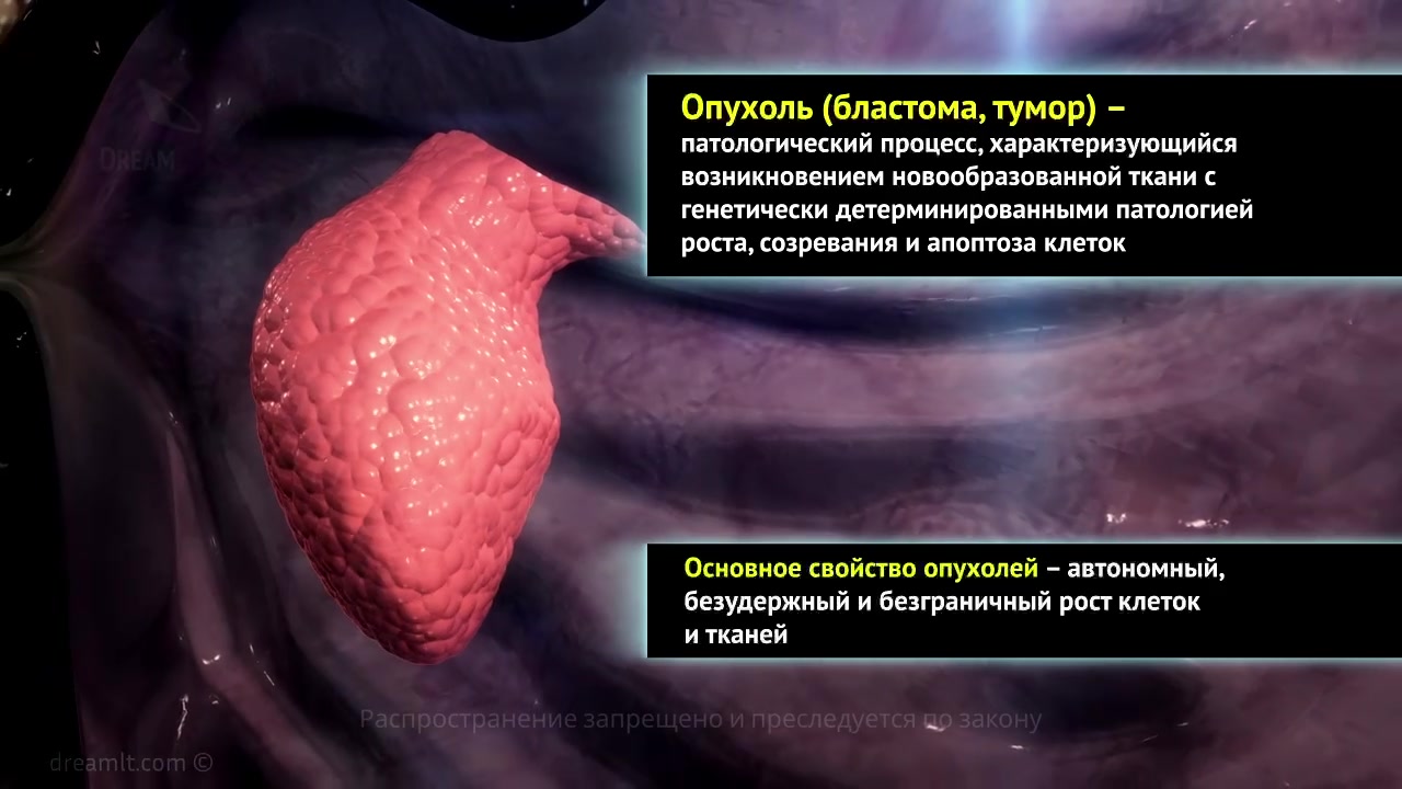 Опухоли